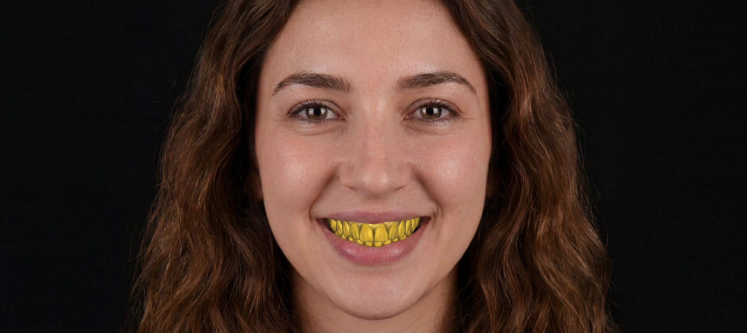img-lm-a
